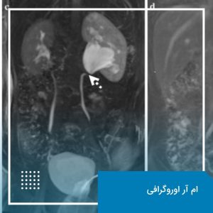 ام آر اوروگرافی (MRU) چیست؟ مزایا و کاربردها 1 ام آر اوروگرافی (MRU)