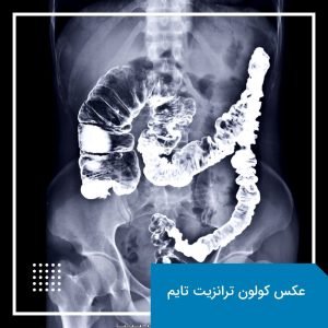 عکس کولون ترانزیت تایم یا رادیولوژی CTT 4 عکس کولون ترانزیت تایم