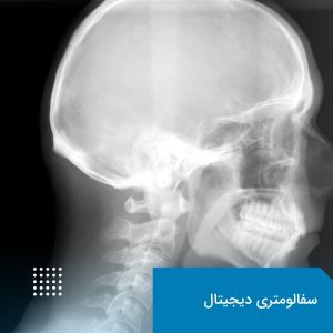 سفالومتری دیجیتال