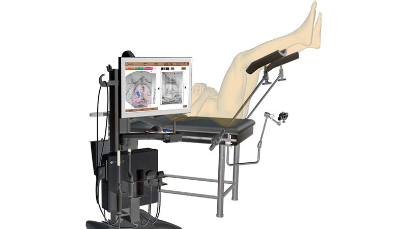 ارتباط MRI پروستات و بیوپسی پروستات