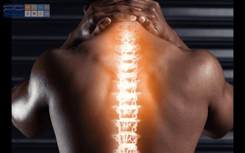 MRI ستون فقرات چیست 3 انواع MRI ستون فقرات (گردن، کمر و ساکرال)