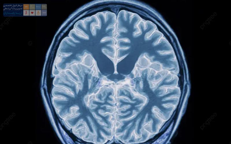 تفاوت MRI مغز با سایر روش‌های تصویربرداری