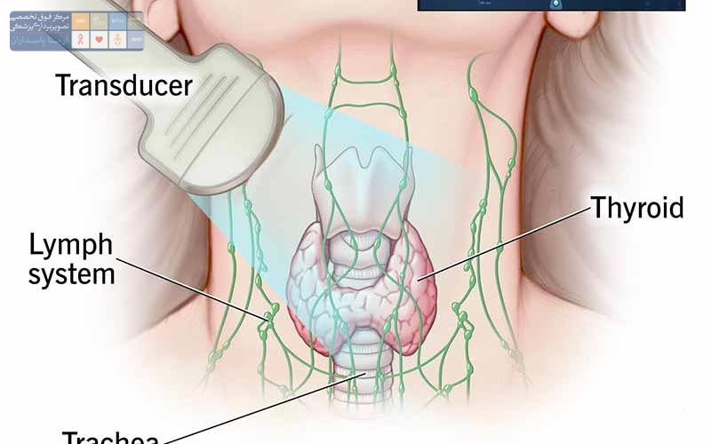 سونوگرافی تیروئید چیست و چگونه کار می‌کند؟