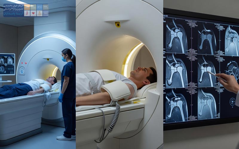 MRI گردن 4 MRI شانه
