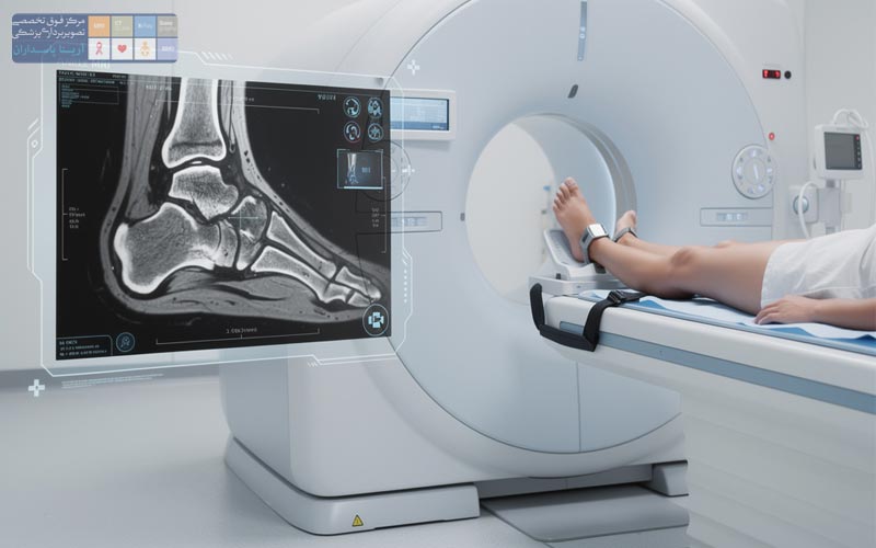 MRI مچ پا