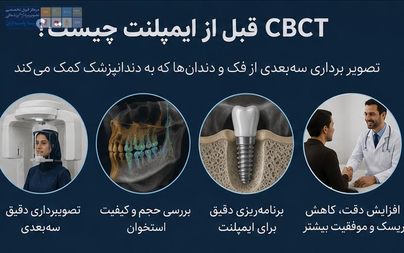 قبل از CBCT ایمپلنت چه آمادگی‌هایی لازم است؟