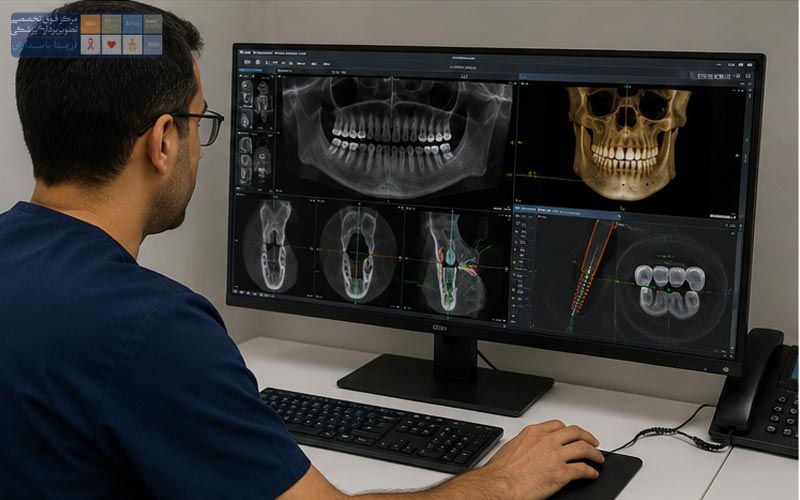 هزینه CBCT قبل از ایمپلنت چقدر است؟