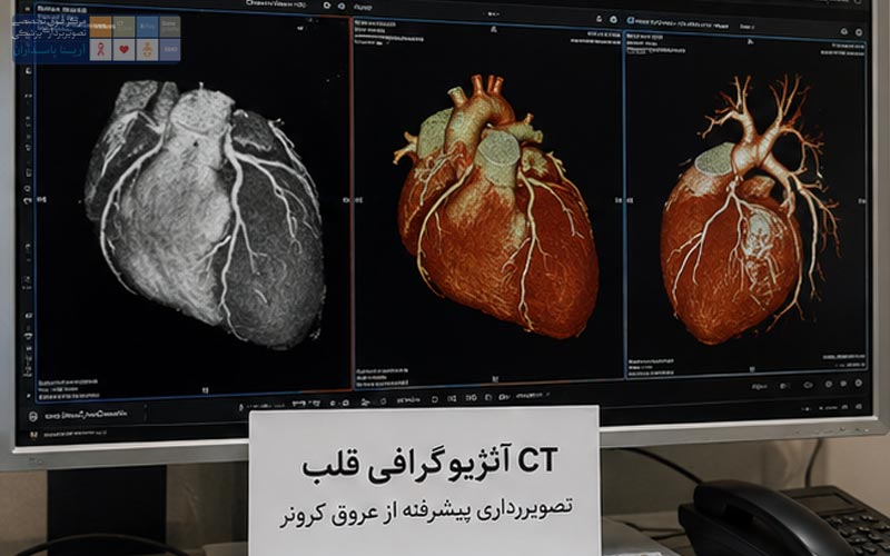 هزینه CT آنژیوگرافی قلب چقدر است؟