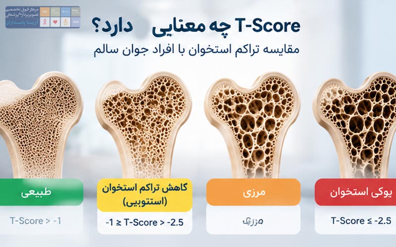 جواب سنجش تراکم استخوان