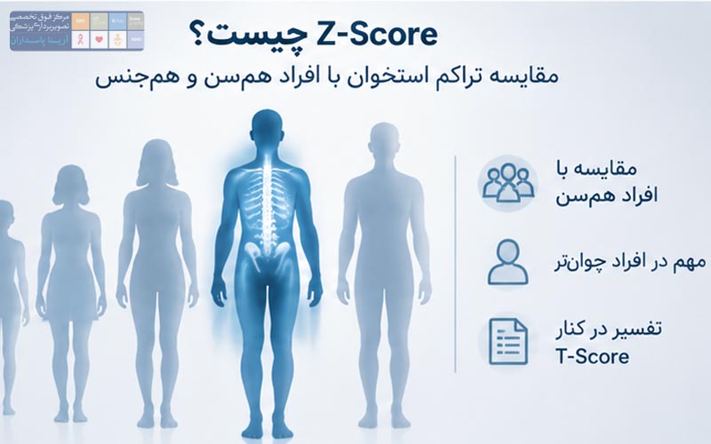 Z Score چیست