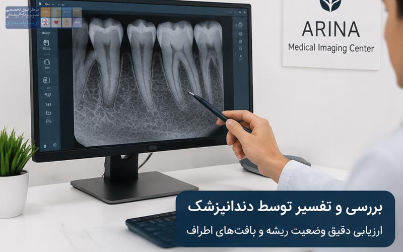 عکس ریشه دندان چیست؟ 4 بررسی عکس Peiapical