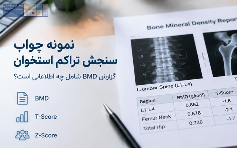تفسیر جواب سنجش تراکم استخوان