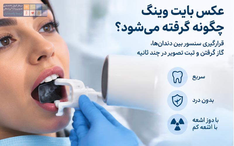 عکس بایت وینگ دندان چیست؟