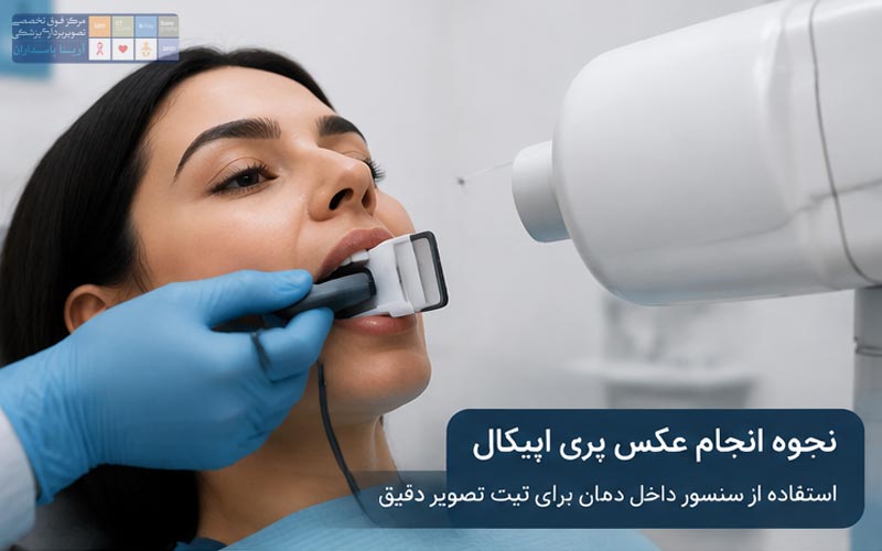 عکس ریشه دندان چیست؟ 1 نحوه انجام عکس پری اپیکال