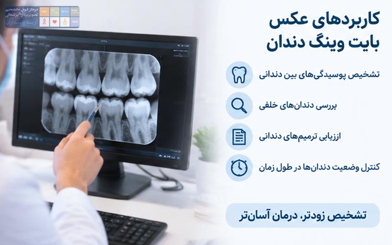 نحوه گرفتن عکس بایت وینگ چگونه است؟