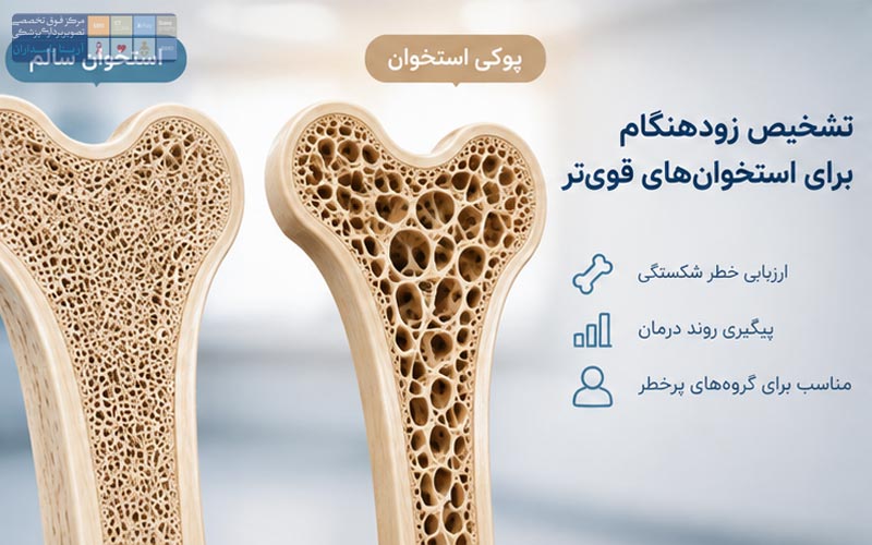چه زمانی برای سنجش تراکم استخوان مراجعه کنیم؟